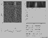 Radio pulses